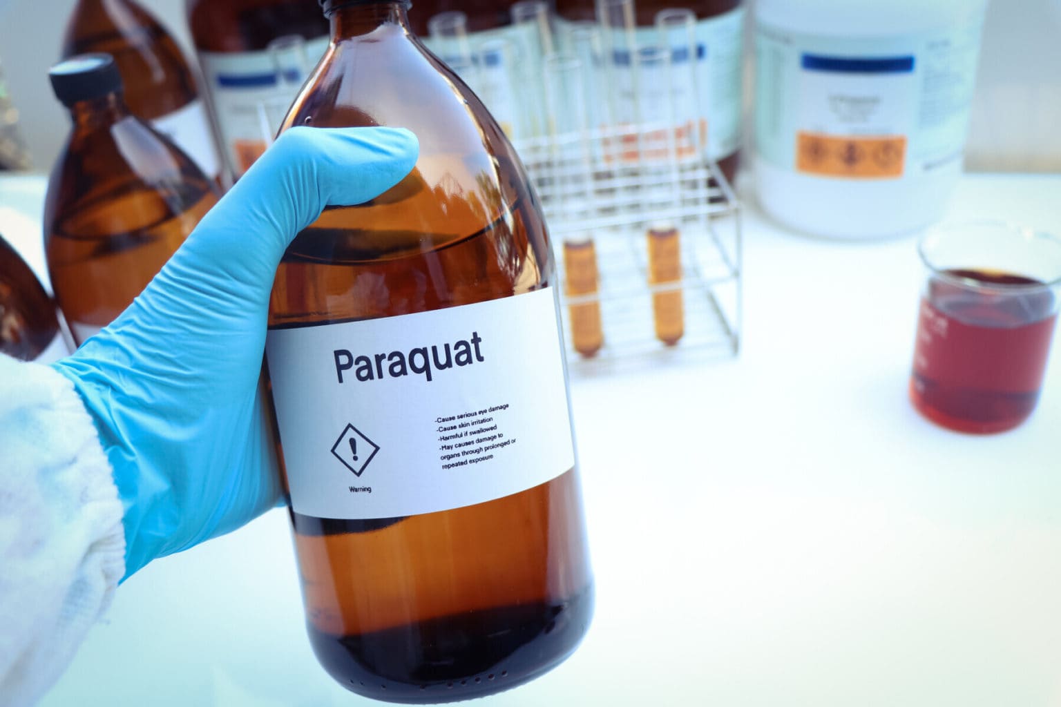 Imagen principal del artículo: Hospital Nacional de Niños alerta sobre intoxicaciones infantiles con paraquat