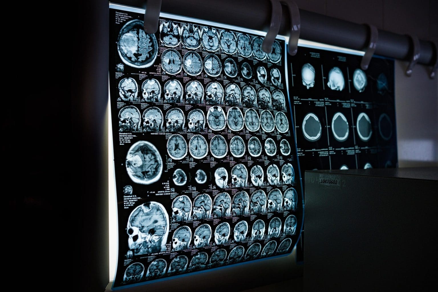 Imagen principal del artículo: La inteligencia artificial plantea un nuevo reto para la tecnología biomédica