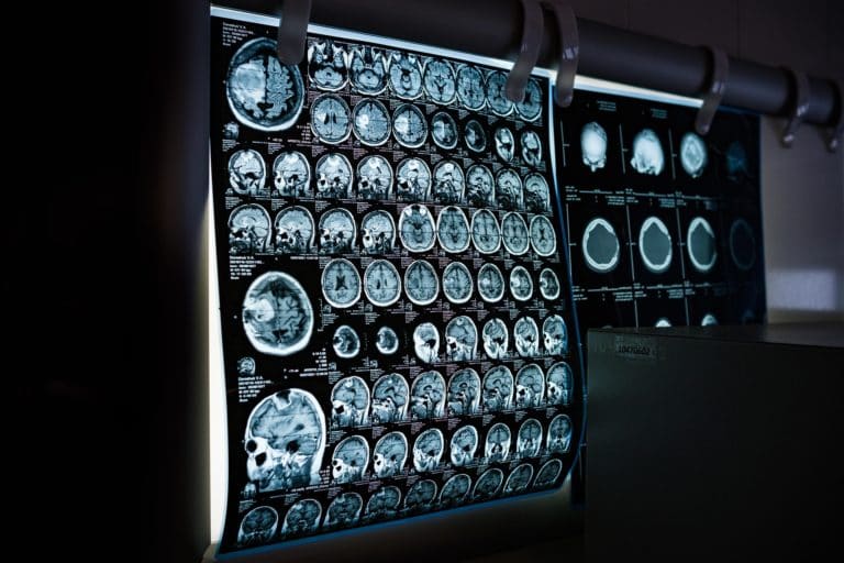 La inteligencia artificial plantea un nuevo reto para la tecnología biomédica